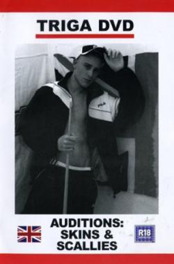 Auditions : Skins & Scallies - DVD Triga